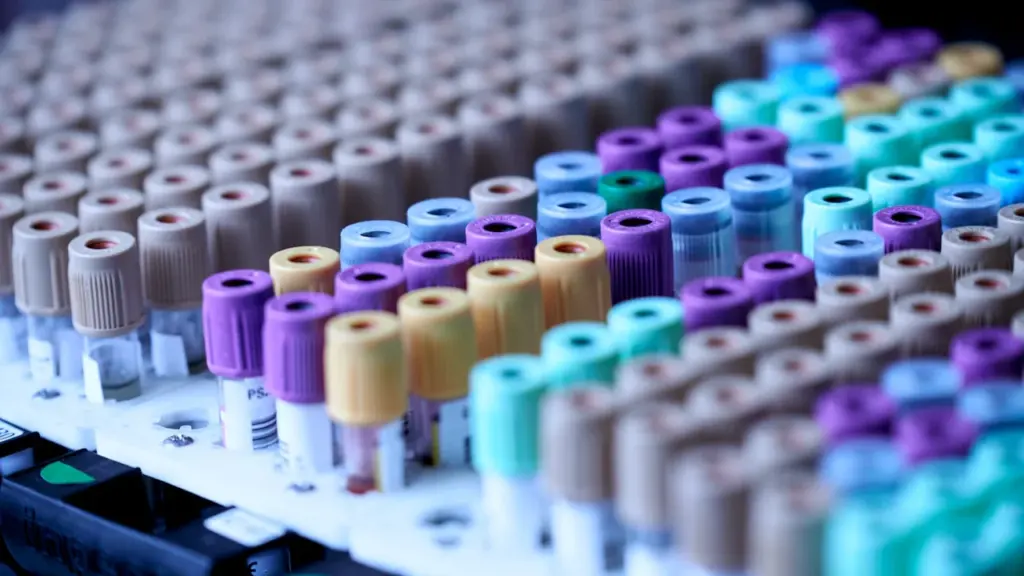 Medicininiai kraujo mėgintuvėliai laboratorijos stovelyje Nacionalinio kraujo centro donorystės akcijos kontekste